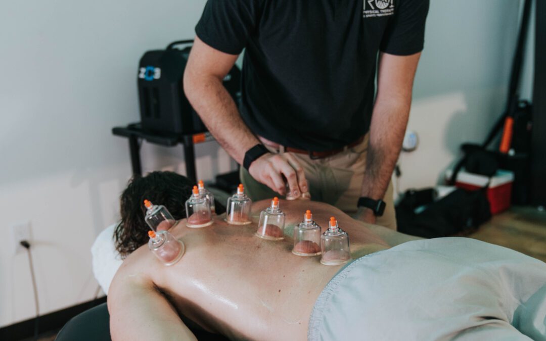 Cupping Benefits You Should Expect